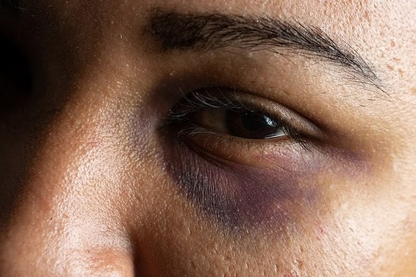  Homem é preso após agredir e ameaçar companheira com uma faca
